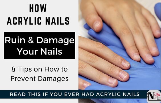 How Acrylic Ruin Your Nails & Tips to Prevent Damages - Easy Nail Tech