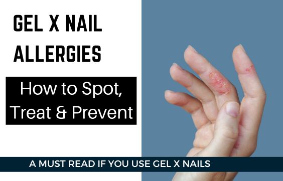 Gel X Nail Allergies How to Spot, Treat & Prevent